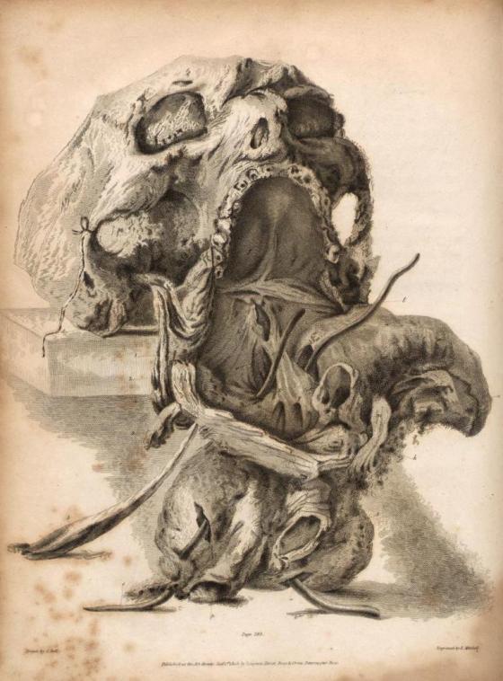  1. 'Dissection of a pharynx affected by abscess, shown at post-mortem' from 'Principles of Surgery' by John Bell, 1801.