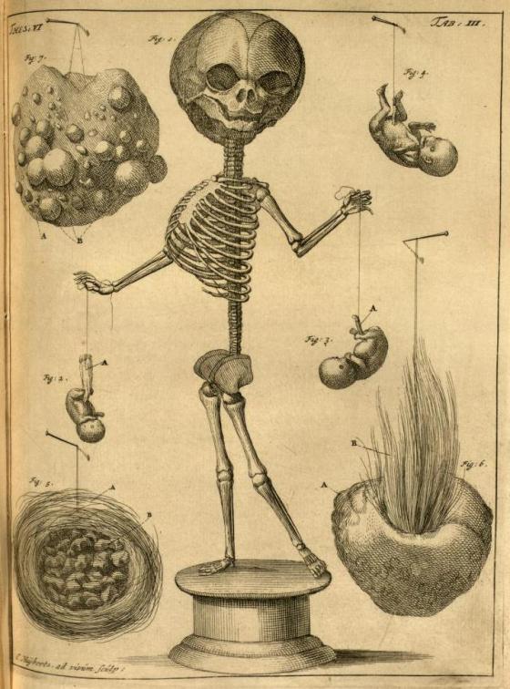 3. 'Fetal skeleton, placenta and embryo, and examples of arteriosclerosis' from Thesaurus Anatomicus by Frederik Ruysch, 1701.